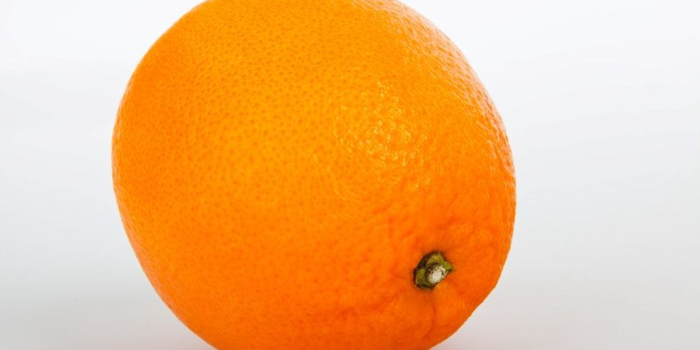 Celulite ou lipodistrofia ginóide Celulite ou lipodistrofia ginóide